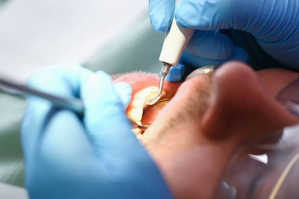 Best Emergency Root Canal Therapy in Dixmoor, IL