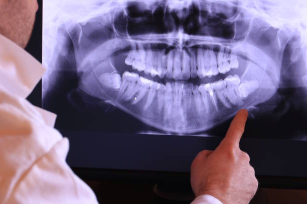 Best Emergency Treatment for Oral Infections in Dixmoor, IL